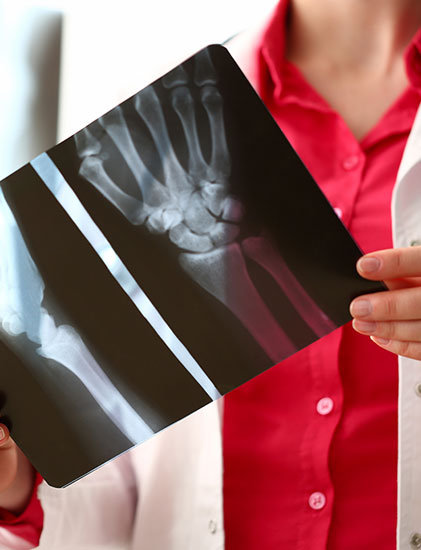 hand x-ray