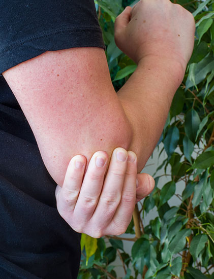 elbow pain