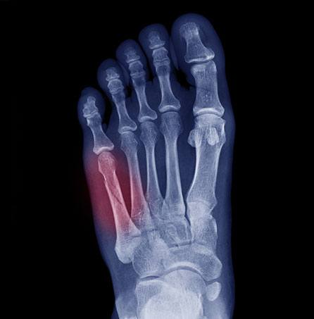 foot x-ray