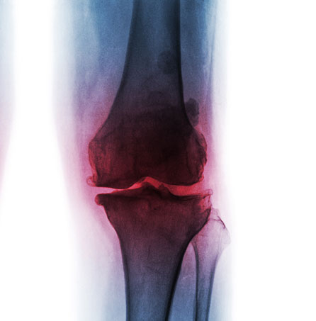 knee x-ray