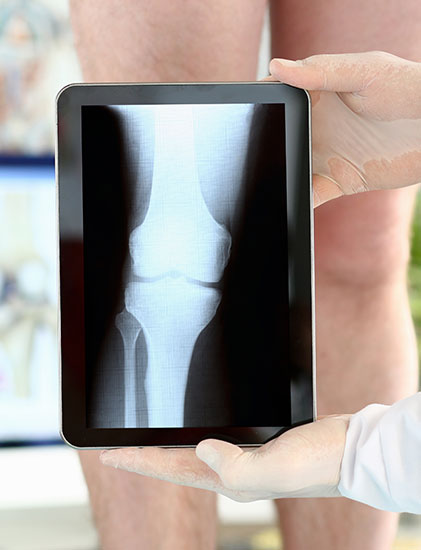 knee x-ray
